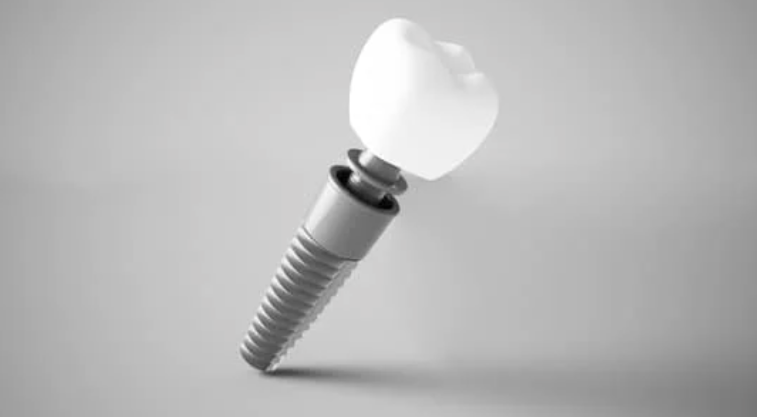 Dental Implant
