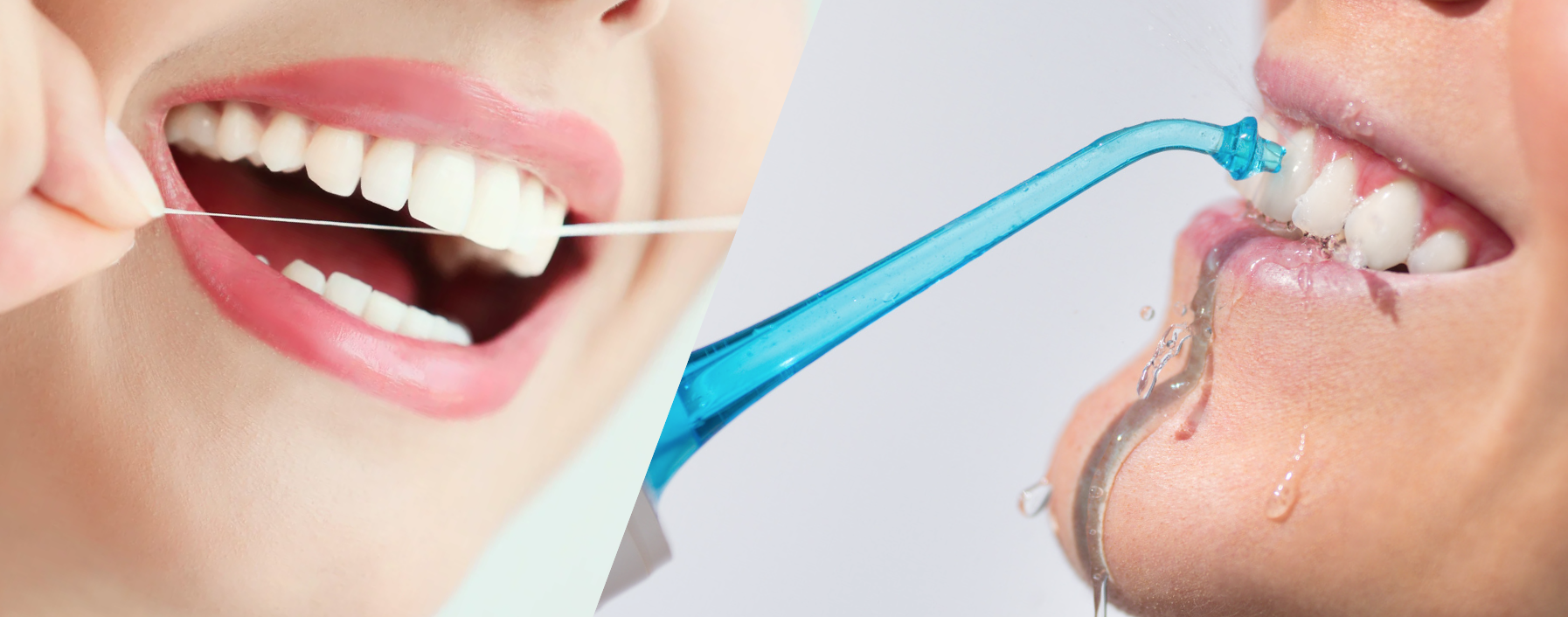 dental floss vs water flosser