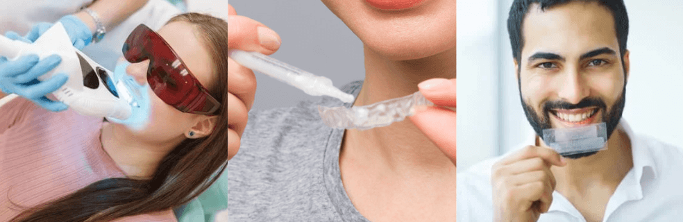 The different types of teeth whitening