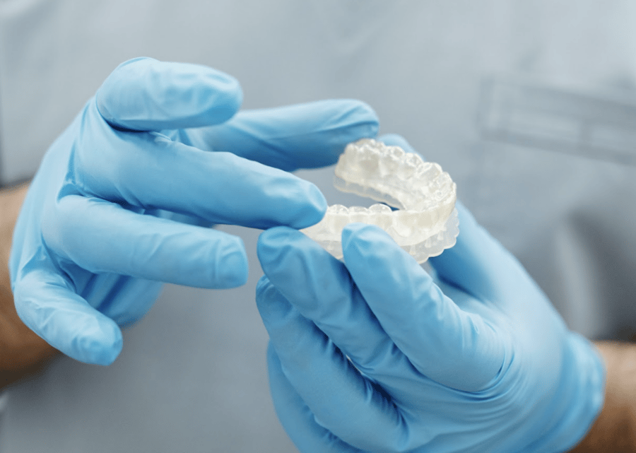 Aligner Treatment