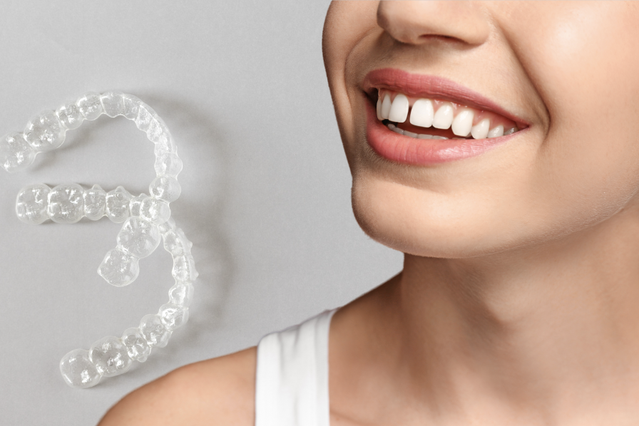 Invisalign for gapped teeth