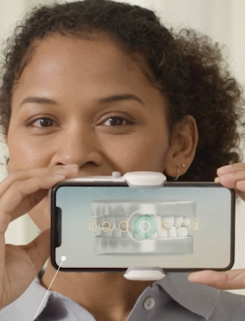Dental Monitoring