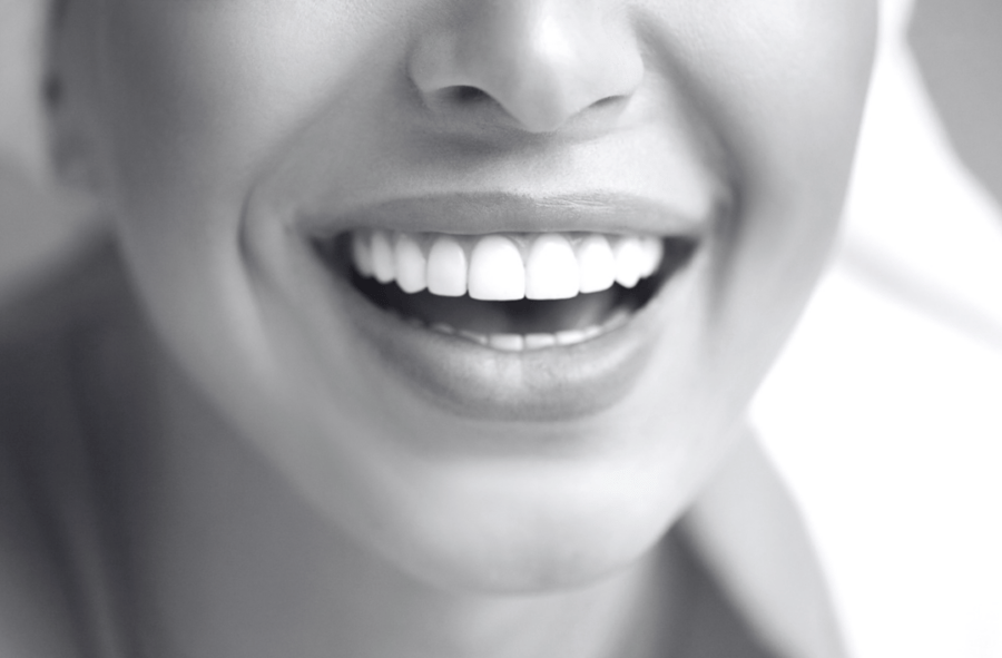 Bright Smile