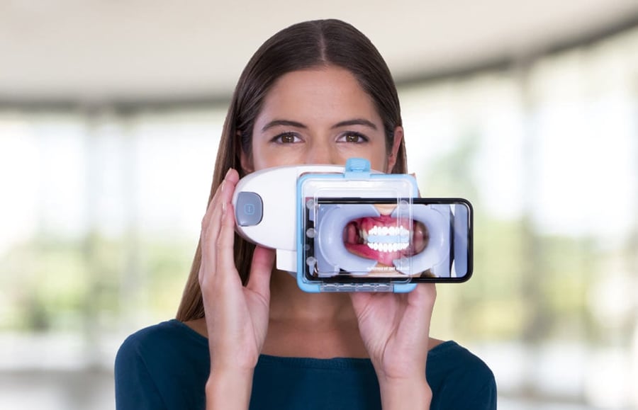 3D Scanner