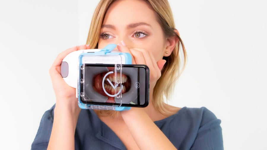 Dental Monitoring