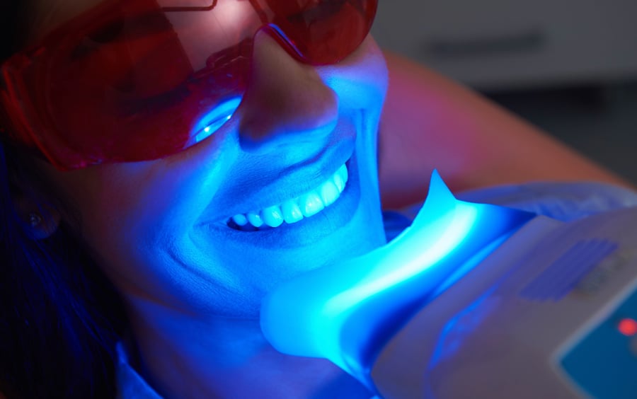 Professional teeth whitening treatment