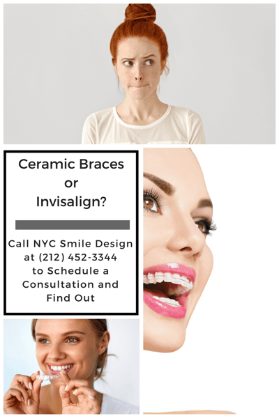 Ceramic Braces Cost NYC | Financing Invisalign Manhattan