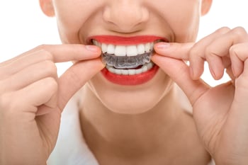 Invisalign in Manhattan | Clear Braces NYC