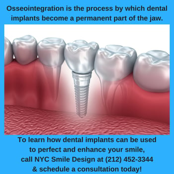 Are you missing one or more teeth? Call experienced and trusted NYC implant dentists Dr. Mello & Dr. Tabib at 212-452-3344 to schedule a consultation today!