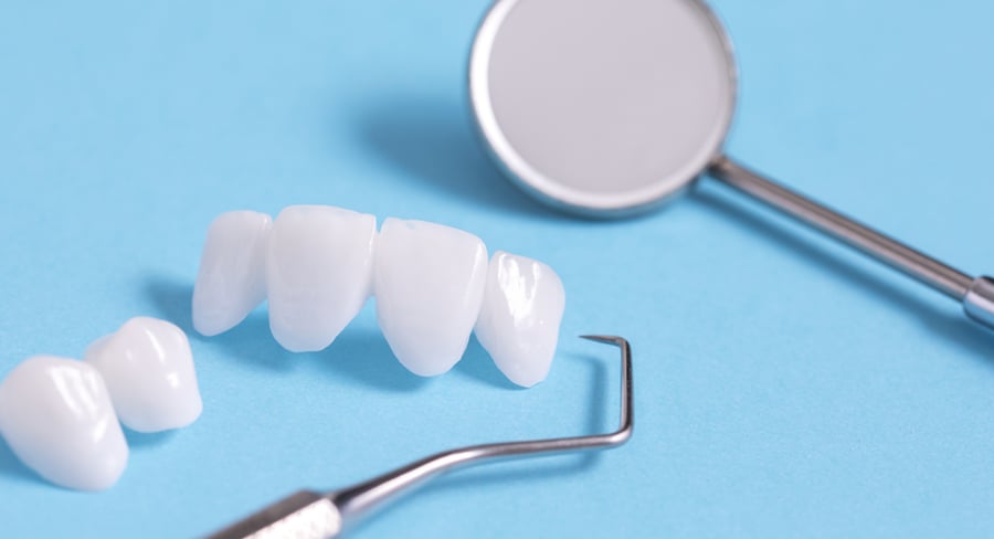 Porcelain Veneers