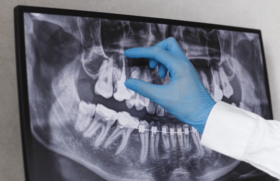 Dentist reviewing X-ray of teeth