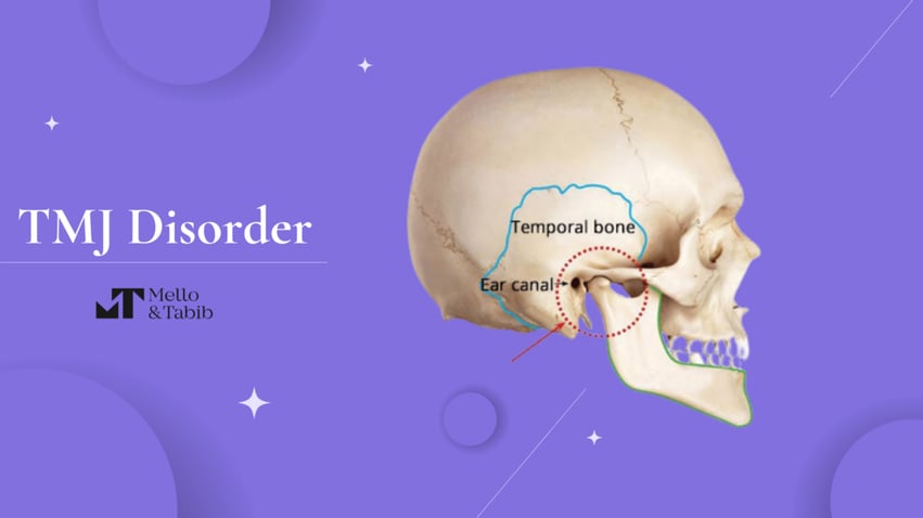 Understanding-TMJ-Operation-Costs-1-1-1100x619-2