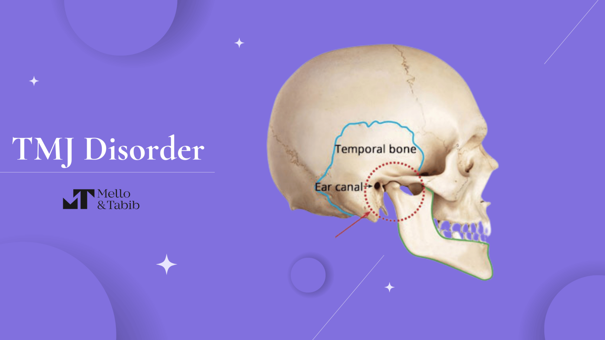 TMJ Diagram