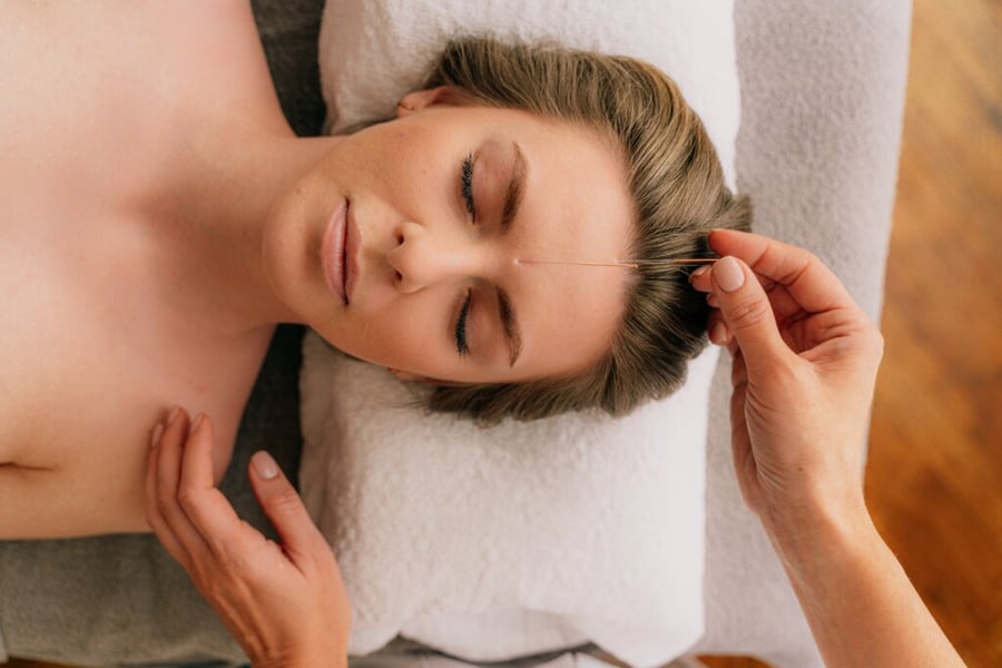 Acupunture