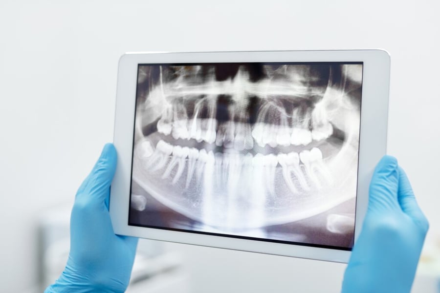 Dentist Reviewing X-rays of teeth