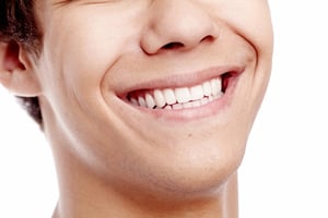 smile makeover tooth reshaping enamel recontouring manhattan new york city cosmetic dentist