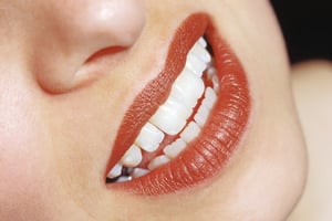 teeth whitening options Zoom! teeth whitening NYC Manhattan cosmetic dentist