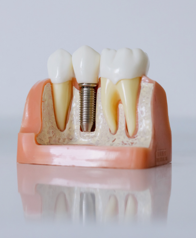 Tooth diagram